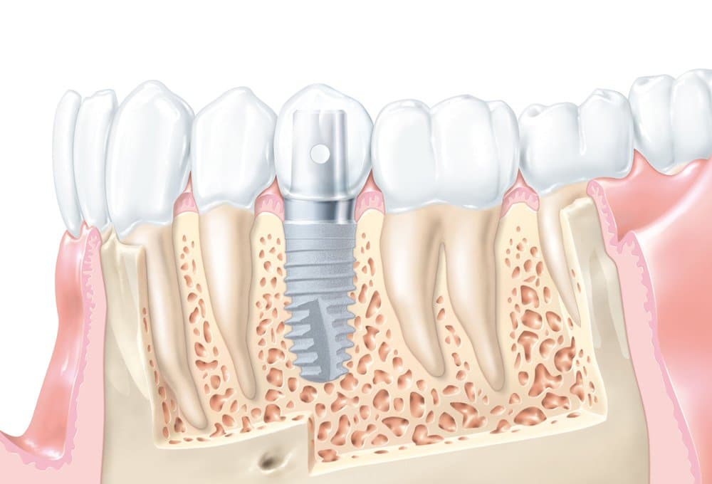 Dentist in Thamesmead